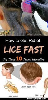 How To Get Rid Of Lice Fast 10 Best Home Remedies Home Lice Remedies Herbal Remedies Remedies