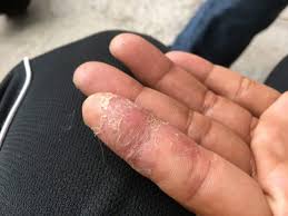 Secara ilmiah, bunga lawang dikenal dengan nama illicium verum. 6 Manfaat Mujarab Bunga Lawang Yang Sayang Dilewatkan Kegunaan Efek Samping Interaksi Hello Sehat