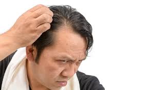 Cortisol is a stress hormone. Plant Derived Phytochemicals Show Promise As Hair Loss Treatment Says International Journal Of Cosmetic Science