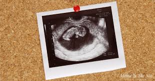 This test measures the size of the clear tissue, called the nuchal translucency, at the back of your baby. Ten Questions Every Pregnant Woman Should Ask
