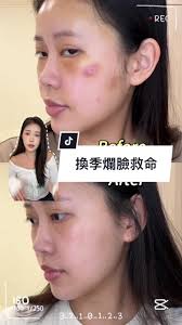 秋冬換季皮膚超搞💢 @Clinique #倩碧 #美國第一皮膚科醫學品牌 #水磁場100H保濕凝膠 #MySensitiveSide #護膚 #保濕  #換季保養 #保養 #保養品 #skincare #skincaretips