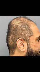 هل عدم الرأس المسطح للأطفال قد يسبب مشاكل مستقبلية؟