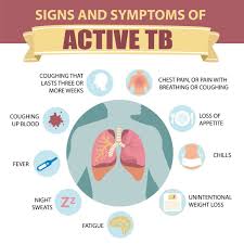 Signs Symptoms Of Active Tb Medical Knowledge Medical Laboratory Science Good Health Tips