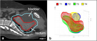 We can understand ellipse as an elongated circle. The Stacked Ellipse Algorithm An Ultrasound Based 3 D Uterine Segmentation Tool For Enabling Adaptive Radiotherapy For Uterine Cervix Cancer Ultrasound In Medicine And Biology
