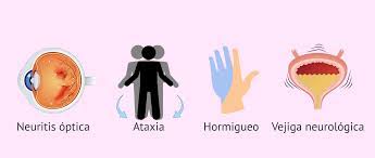 We did not find results for: Sintomas De La Esclerosis Multiple Em