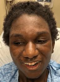 Young man with 'severe autism' missing, Shreveport police alert public