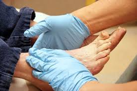 Diabetic foot care near me. Diabetic Foot Treatment Podiatrist Lehi Ut 84043 Murray Ut 84123
