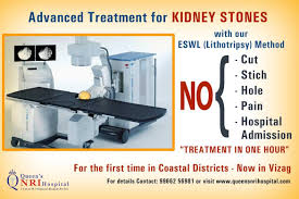 Eswl Lithotripsy Method For Kidney Stones For More Info Visit Queensnrihospital Com Best Hospitals Care Hospital Kidney Stones