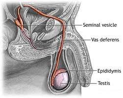 Image result for Vasectomy