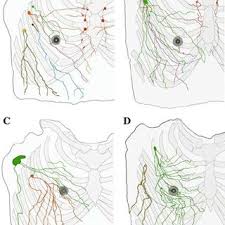 Want to learn more about it? Pdf The Lymphatic Anatomy Of The Breast And Its Implications For Sentinel Lymph Node Biopsy A Human Cadaver Study