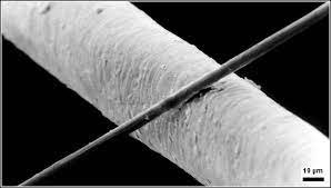 The micron is symbolized by the greek lowercase letter mu the diameter of human hair varies from about 40 microns to 120 microns. Micrometre Wikipedia