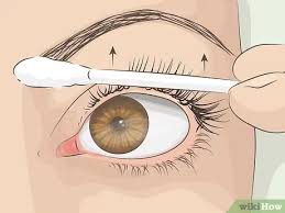 Thank you for your question and i'm sorry to hear about your accident. 4 Ways To Curl Your Eyelashes Without An Eyelash Curler Wikihow