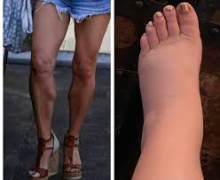 Shot dead woman feet / woman 'shot dead in argument over how to cook scrambled eggs' : Jessica Simpson Just Made Her Swollen Pregnancy Feet A Meme Metro News