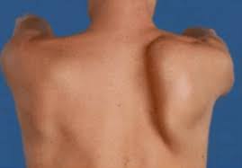 Maybe you would like to learn more about one of these? Tulang Belikat Menonjol Di Manakah Letak Masalahnya Bookingdokter Health Reservation Everywhere