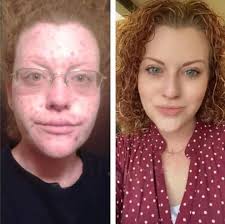 NeighborsofBaker.org Andy Micka