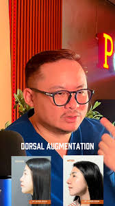 Hi everyone! I am Dr. Alfred Peter Justine E. Dizon, an Ears Nose Throat  (ENT), Head & Neck Surgeon with a subspecialty in facial plastic surgery.  Learn more in the coming days
