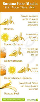 5 Banana Face Masks For Acne Clear Skin Within Days Skinmaskinfographic Banana Masks Acne Infographic In 2020 Banana Face Mask Homemade Acne Treatment Banana Mask