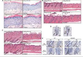 Following elisa screening, the results may be negative, positive, or inconclusive. Figure 3 From Cd34 Expression By Hair Follicle Stem Cells Is Required For Skin Tumor Development In Mice Semantic Scholar