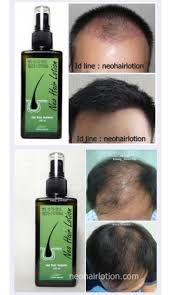 Maybe you would like to learn more about one of these? Neo Hair Lotion For Android Apk Download