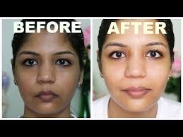 Immediate Skin Lightening How To Use Bleach Skin Care Routine Skin Bleaching Bleaching Your Skin Lighten Skin
