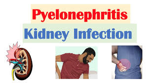 Image result for Acute Pyelonephritis