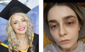 I wish I could afford treatment without burdening anyone else. I have  nowhere left to turn'