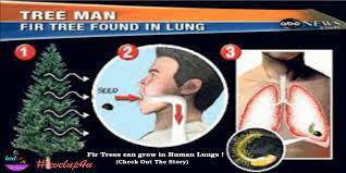 Free lung tree vector download in ai, svg, eps and cdr. Tree Man Shocked Surgeons Claim Too Strange To Be True Did Fir Branch Prick A Lung Fact The World Levelup4u Video Dailymotion