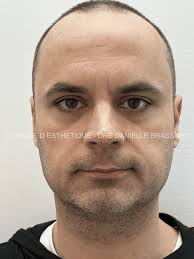 Cosmetic Dermatology & Medical Aesthetic clinic in Laval