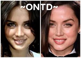 She later returns as a vampire. Ana De Armas Plastic Surgeries Ontd Original Ohnotheydidnt Livejournal