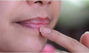 Memiliki bibir merah merona yang alami tentu menjadi keinginan setiap orang, terutama kaum hawa. Kamu Sering Merokok Dan Bibir Kamu Jadi Hitam Ini Tips Cara Mengatasi Agar Bibir Kamu Tidak Hitam Winnetnews Com