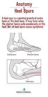 This Site Explains What Are Heel Spurs And How They Relate To Plantar Fasciosis Heel Spurs Muscle Disorders Health And Wellbeing