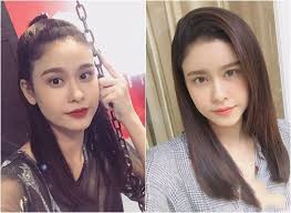 Hiện tại sức khỏe quỳnh anh đã ổn định, bác sĩ còn dặn mổ xong không cần kiêng cữ gì, nhưng quỳnh anh vẫn cố gắng tự kiêng, ăn uống healthy cho chắc. TrÆ°Æ¡ng Quá»³nh Anh Bá»‹ Lá»™ NhÆ°á»£c Ä'iá»ƒm Khi Dan Máº¡ng KhÆ¡i Láº¡i áº£nh CÅ© So Sanh Vá»›i áº£nh Má»›i Sau Pháº«u Thuáº­t