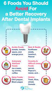 It is vitally important that you avoid drinking hot coffee. 6 Foods To Avoid After Dental Implants Dental Implant Surgery Dental Implants Dental