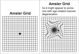 4 Amsler Grid Macular Eye Chart Www Bedowntowndaytona Com