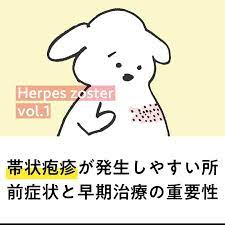 帯状疱疹が発生しやすい部位と前触れ症状 早期治療の重要性 症状 治療 早期