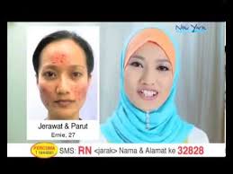 For the last 15 years, many have had their dreams of desiring radiant skin fulfilled. Rahsia Kejelitaan Siri Tv Untuk Kecantikan Dari New York Skin Solutions Selasa 6 Petang Wanista Com