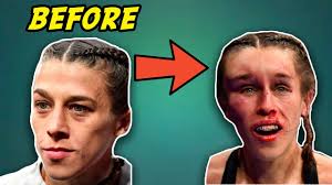 Ufc 211׃ joanna jędrzejczyk • play with fireᴴᴰ highlights ⁄ promo. Massive Hematoma Doctor Explains Joanna Jedrzejczyk Forehead At Ufc 248 Youtube