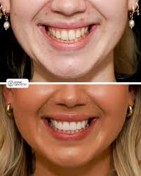 Meet our newest Iconic Dentist! A huge welcome to Dr Sally McMullen who  joins our team. Sally is an exceptional dentist with 12 years of  experience. She is currently leveling up by