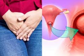 Check spelling or type a new query. Jadi Kanker Keempat Paling Sering Dialami Wanita Ini Gejala Kanker Serviks Yang Harus Diwaspadai Semua Halaman Intisari