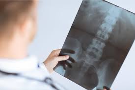 Image result for Low Back Imaging