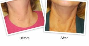 Strivectin Tl Advanced Tightening Neck Cream Giveaway Prime Beauty Blog Neck Cream Beauty Blog Beauty