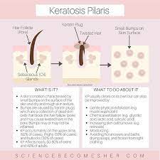 How To Look Younger Than Your Age 7 Scientific Secrets To Looking Younger Science Becomes Her Skin Care Keratosis Pilaris Skin