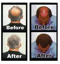 5 ron passed away at 86 Ron Popeil Archives As Seen On Tv Video