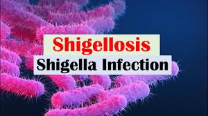 Image result for Shigella