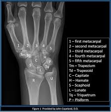 Image result for Normal Anatomic Position of the Hand and Wrist