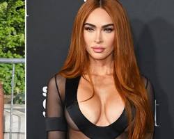 Imagen de Megan Fox before and after plastic surgery