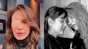 Yolanda Andrade desata preocupación luego de recibir doloroso tratamiento |  Univision Famosos | Univision