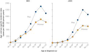 The clinical trials on thi. Incidence And Trends Of Basal Cell Carcinoma And Cutaneous Squamous Cell Carcinoma Mayo Clinic Proceedings
