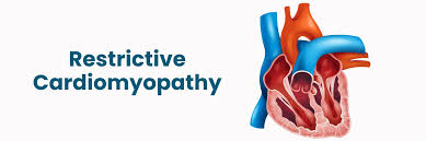 Image result for Restrictive Cardiomyopathy