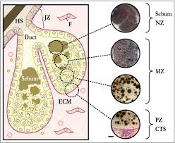 Image result for Sebaceous Gland